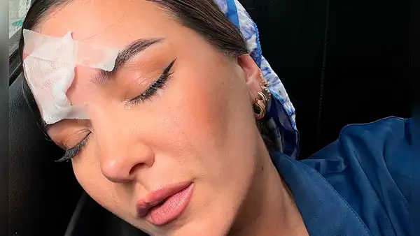 Ale Fuller sufre accidente durante grabación de 'El gran chef famosos: la revancha' y preocupa a fans