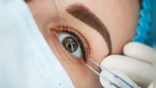¿Qué es la queratopigmentación? La peligrosa operación cosmética podría dejarte sin visión