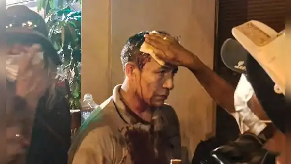 Hombre resulta herido durante manifestación en los exteriores del Congreso de la República