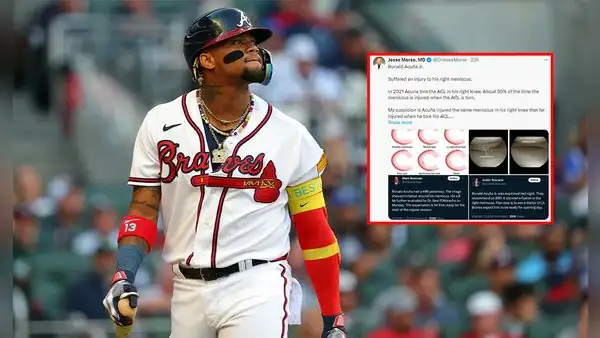 ¿Ronald Acuña Jr. superará su lesión?: este fue el llamativo análisis de médico especialista