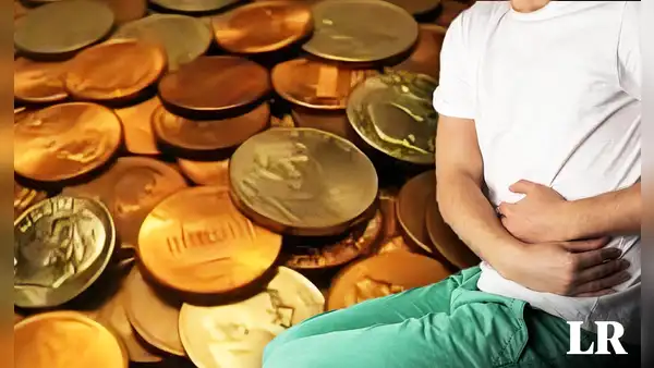 Hombre se salva de morir tras ingerir 39 monedas y 37 imanes: decía que "el zinc ayuda en el culturismo"