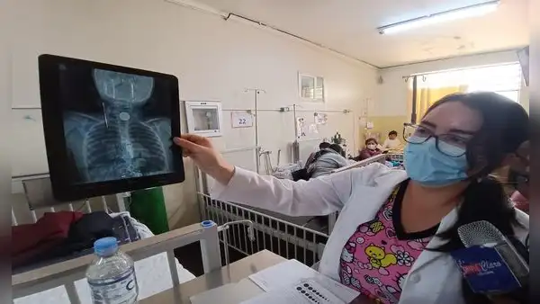 Cusco: denuncian que médicos negaron atención a niña que se tragó moneda en su primer día de clases