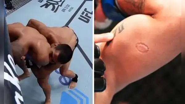 Luchador mordió a su rival, fue expulsado y el dueño de UFC regaló 50.000 dólares al afectado