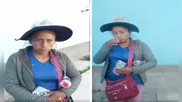 Madre necesita 70.000 soles para reconstruir rostro de su hijo, quien sufrió accidente en Arequipa