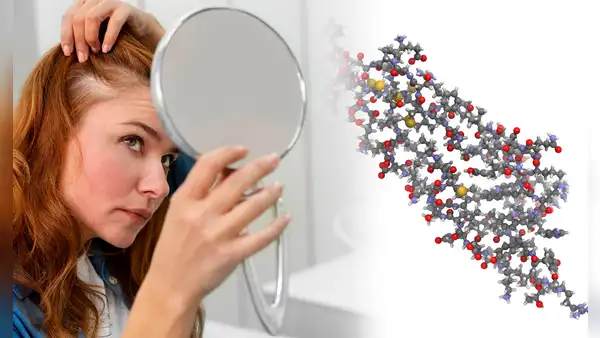 ¿Adiós a la alopecia? Científicos descubren sustancia que podría acabar con la caída de cabello