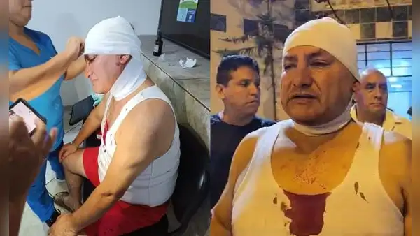 Ulises Villegas, alcalde de Comas, denuncia que sufrió atentado tras amenazas de muerte