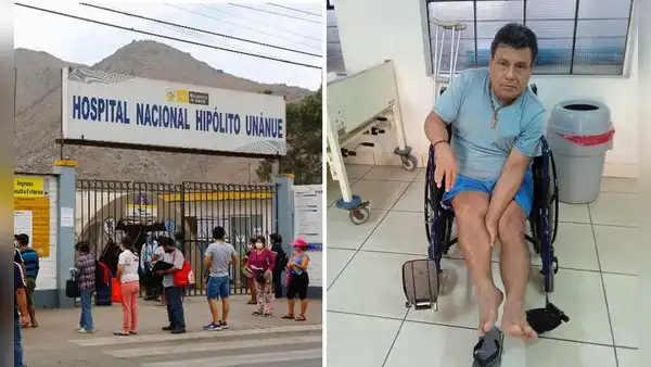 Vive en hospital más de 1 año: ingresó por fractura y terminó con hueso de pierna recortado