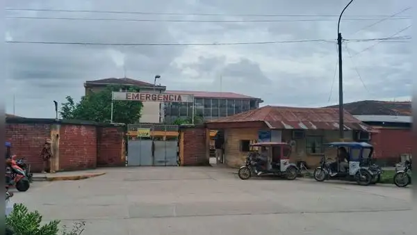 Explosión de grifo en Loreto: joven fallece tras permanecer hospitalizado por graves quemaduras