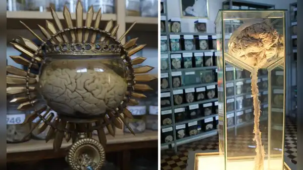 Conoce el museo más raro del Perú: está dentro de un hospital y la entrada solo cuesta S/5