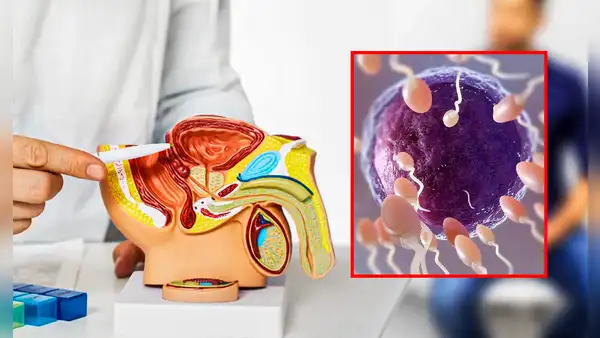 Eyacular al menos 21 veces al mes reduce el riesgo de padecer cáncer de próstata, según estudio de Harvard