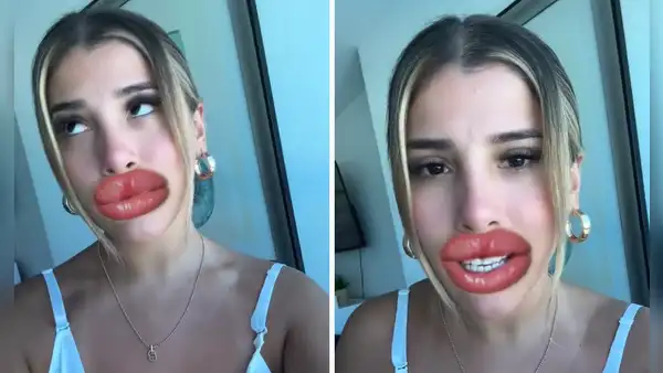 Yahaira Plasencia responde a quienes critican por su retoque estético y usuarios la apoyan: “Para que sigan hablando”