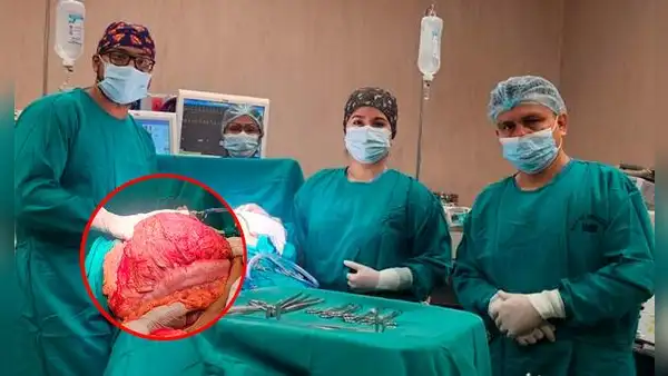 Médicos de Jaén extraen tumor gigante intraabdominal de un hombre: pesaba 12 kilos