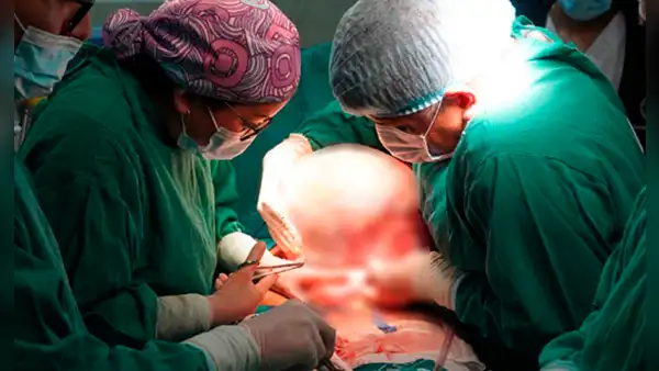 Adulta mayor de 61 años sobrevive a extracción de tumor de más 10kg en hospital de El Agustino