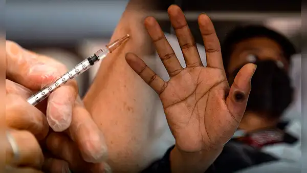 Los casos de mpox en Perú en 2024 y qué se sabe de la vacuna contra el virus, según el Ministerio de Salud