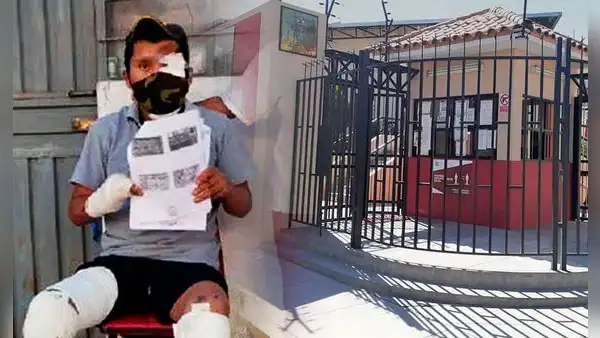 PJ ordena pago de medio millón de soles a favor de heladero que quedó desfigurado tras atropello en Arequipa
