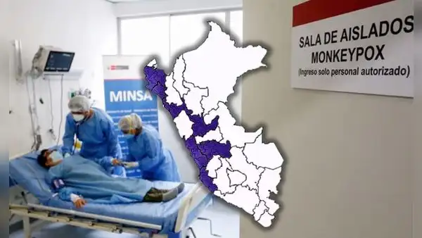 Viruela del mono aumenta diariamente en el Perú: cifras, zonas más afectadas y todo lo que se sabe