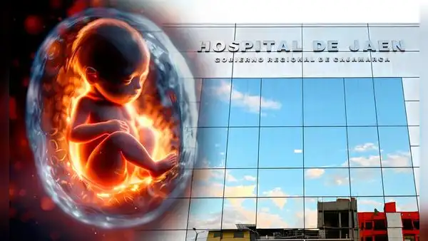 Caso de óbito fetal en Jaén: mujer logra expulsar a su bebé muerto de su vientre después de 3 días