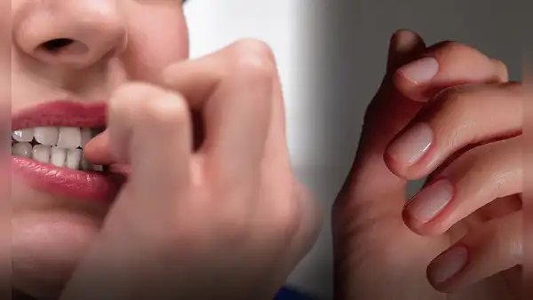 Estas son las ENFERMEADES que puedes contraer al morderte las uñas: podrían provocar la muerte