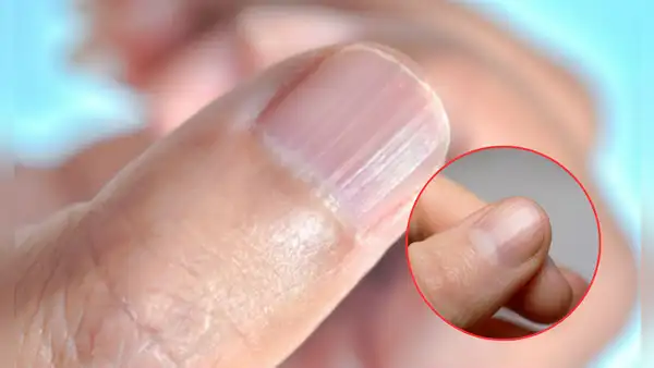 ¿Qué significa tener las uñas con rayas? Esto podría decir de tu salud y así puedes eliminarlas