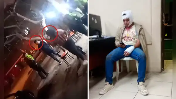 Hermanos con camiseta de Universitario sufren brutal ataque en Los Olivos: sospechan de rivalidad entre barras