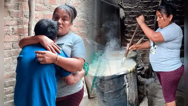Madre de niño que cayó a olla de chicha hirviendo en Piura pida ayuda para costear gastos: "Lleva más de 20 cirugías"