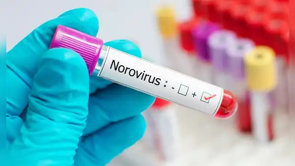 Cuáles son los síntomas del Norovirus y cómo prevenir su contagio en Estados Unidos