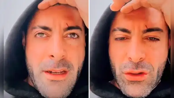 Sebastián Lizarzaburu muestra cicatrices en su rostro y conmueve con emotivo mensaje: “Días complicados”