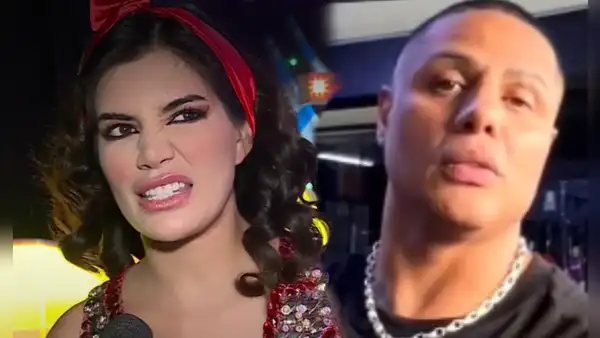 Samantha Batallanos sorprendida por resultado de operación a la nariz de Jonathan Maicelo: "No acepten canjes en la cara"