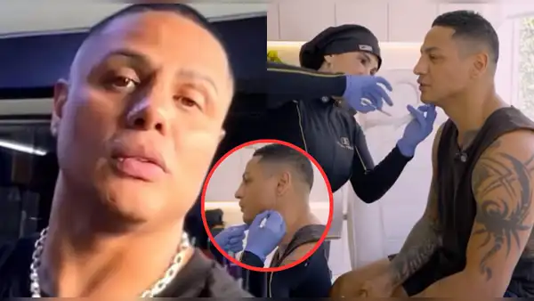 Jonathan Maicelo se habría sometido a otro retoque estético tras su operación de nariz: "Estoy pepa"