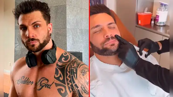Nicola Porcella luce nuevo ‘retoque’ estético en sus redes sociales: “Resultados naturales y duraderos”