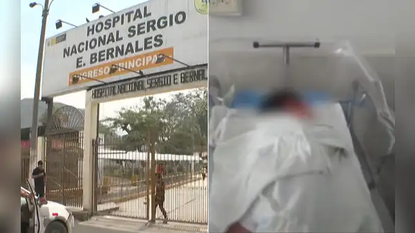 Recién nacido resulta quemado tras presunta negligencia durante su baño en hospital Sergio Bernales de Comas