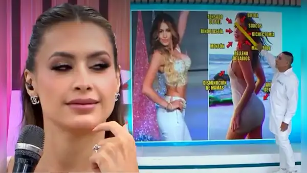 Cirujano expone retoques de Milett Figueroa y ella lo niega en vivo: "El público me ha visto desde los 14 años"