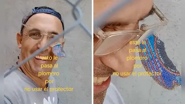 Cuchilla se desprende de cortadora y gasfitero se salva de grave lesión en los ojos: impactante video es viral