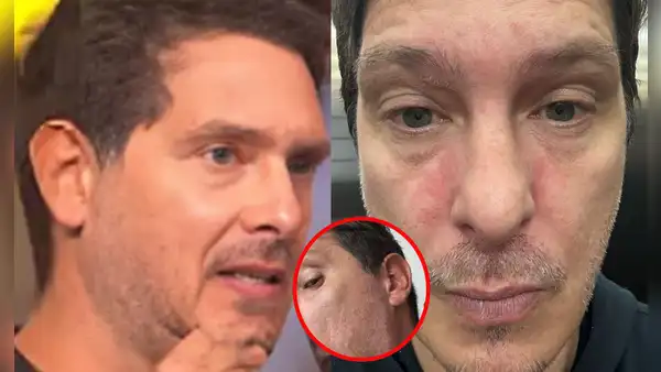 Cristian Rivero revela extraña reacción en su rostro que afecta su salud: “Los nervios existen”