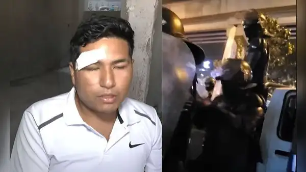 Mototaxista en SJL denuncia que fue asaltado y agredido por fiscalizadores: “Me tiraron al suelo y perdí la conciencia"