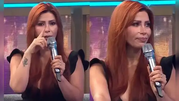 Milena Zárate impacta al revelar su dura batalla contra el cáncer de piel a los 20 años: “Perdí la mitad de mi nariz”