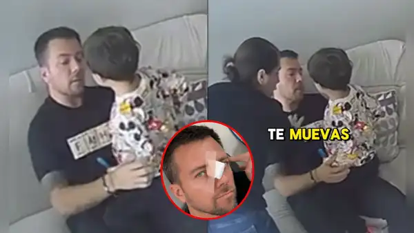 Julián Zucchi muestra el preciso momento de su accidente en casa de Yiddá Eslava y la reacción de la actriz: "Una cicatriz más"
