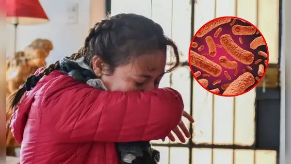¿Qué es la tos ferina, cuáles son sus síntomas y cómo prevenir el contagio?