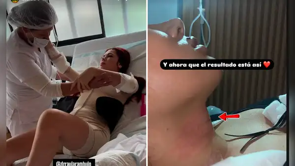 La ‘Uchulú’ impacta con radical cambio tras cirugía para reducirse ‘la manzana de Adán’ y costillas: “Pienso hacerme la voz en Colombia”