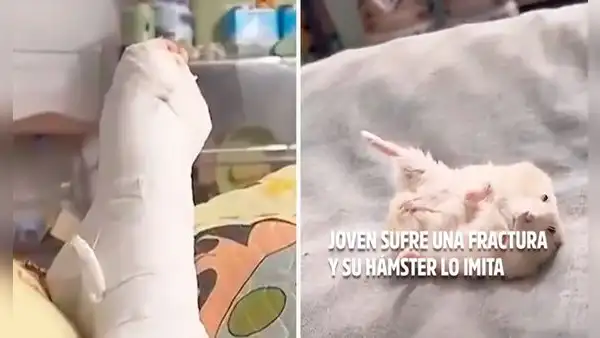 Pequeño hámster roba corazones en redes al imitar a su dueño que sufrió una fractura en la pierna