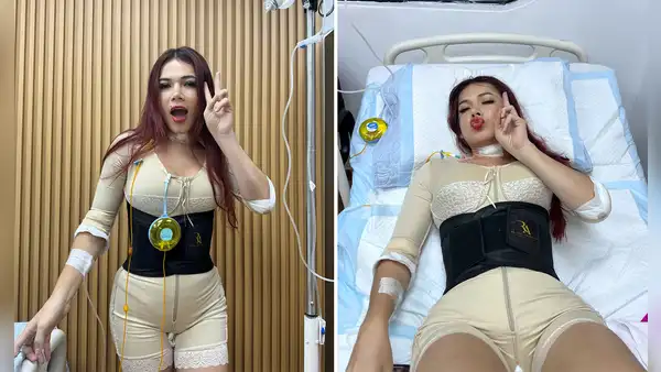 'La Uchulú' comparte fotos del resultado de sus cirugías estéticas en redes sociales: "Me transformé"