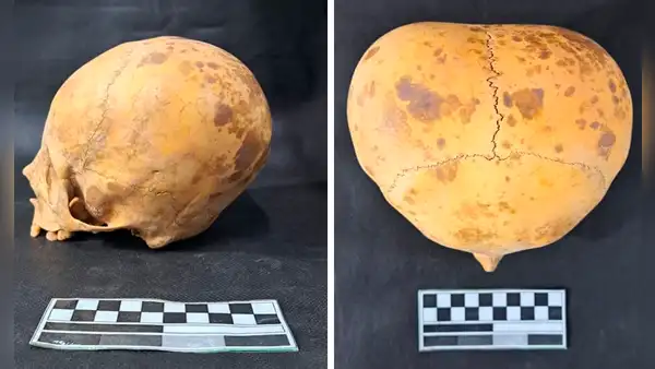 Arqueólogos resuelven el misterio de un cráneo con presunto aspecto ‘alienígena’ encontrado en Sudamérica