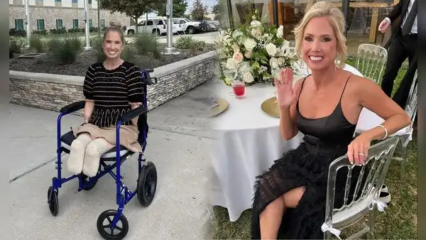 Maestra de secundaria fue al hospital creyendo que tenía un resfriado y tuvieron que amputarle todas las extremidades en Texas