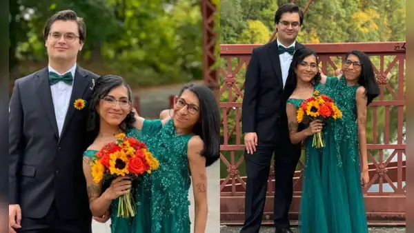 Carmen Andrade, siamesa mexicana, se casó con su novio en EEUU tras cinco años de relación: se conocieron en una app de citas