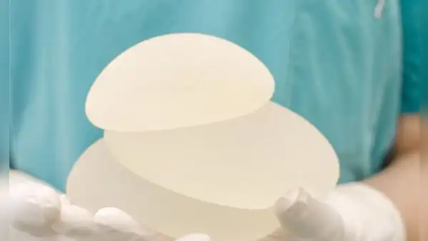 Alerta internacional por implantes médicos prohibidos en Brasil: Digemid continúa evaluando uso de productos en Perú