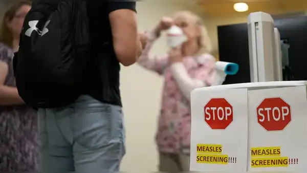 Cifras de sarampión en Canadá baten récord en todo América con más de 4.500 casos
