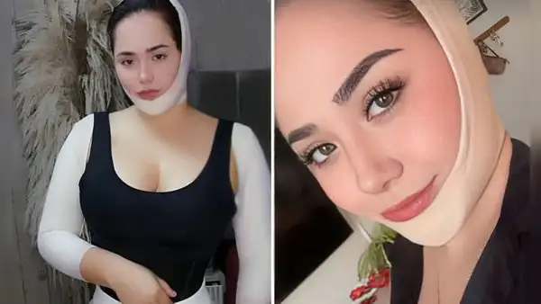 Ana Lucía Urbina de Corazón Serrano cuenta todos los detalles de su operación en el rostro y cuerpo