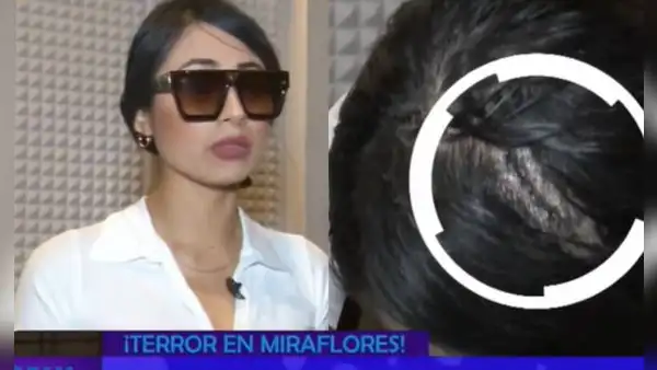 Bárbara Cam, exMiss Perú Áncash, denuncia brutal agresión en conocida discoteca: le rompieron la cabeza y tuvieron que ponerle varios puntos