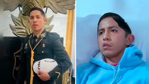 Policía sufre daño cerebral tras caer 4 metros por limpiar una ventana en comisaría de SJM: orden violaba reglamento policial