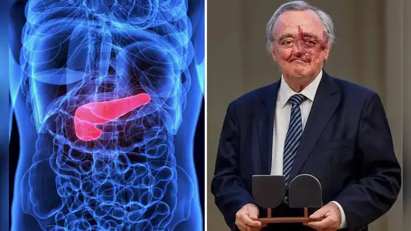 De la investigación al laboratorio: Mariano Barbacid y el paso que podría cambiar el cáncer de páncreas